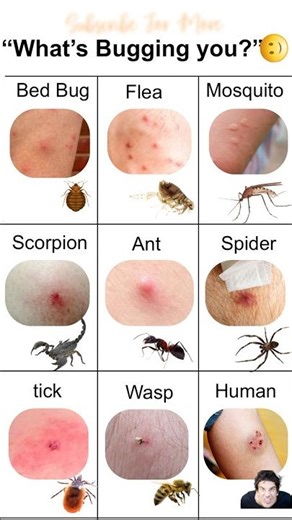 “What’s Bugging You”? - Fun Facts #quiz