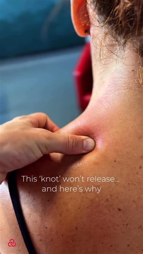 Brain.Body.Balance. on Instagram: "Why can you not release that stubborn shoulder knot with massage alone? Because the knot is not just one tight muscle. At the top of the shoulder, especially around the upper trapezius and surrounding structures, there is a dense intersection of muscles, fascia, nerve pathways, and mechanical load. This region acts like a busy junction where movement, posture, breathing patterns, and emotional tension all meet. When this area becomes tight, it is rarely a simpl