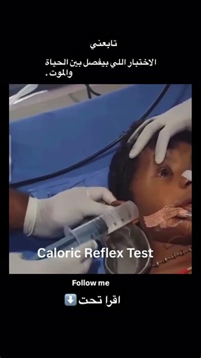 الاختبار الفاصل بين الحياة والموت!!!