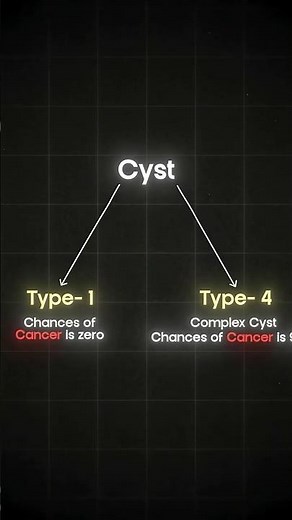 Know the Difference: Cyst Type 1 & Type 2 | Dr. Rahul Jena, Uro Oncologist