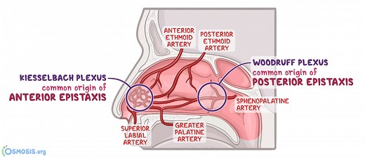 Epistaxis: What Is It, Types, Causes, Prevention, Treatment, and More | Osmosis
