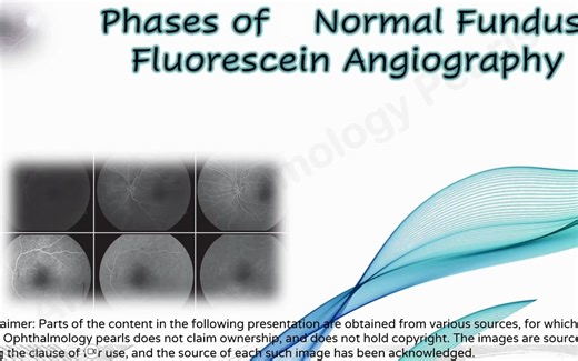 【眼科FFA】Phases of Normal Fundus Fluorescein Angiography - 正常眼底荧光血管造影