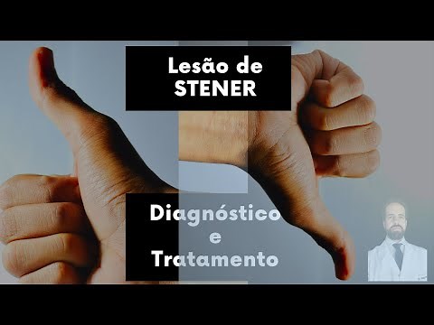 Lesão de Stener - Diagnóstico e Tratamento