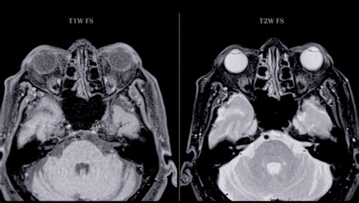 Warning: This Optical Illusion Can Lock Into Your Brain For Hours, Weeks, Or Even Months