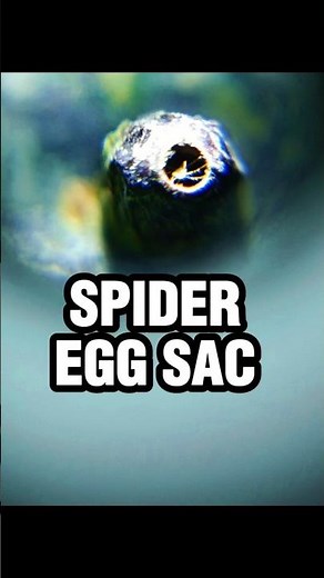 Spider Egg Sac Under Microscope | Leaf Surface Close-Up #microscope #spider #nature #leaf