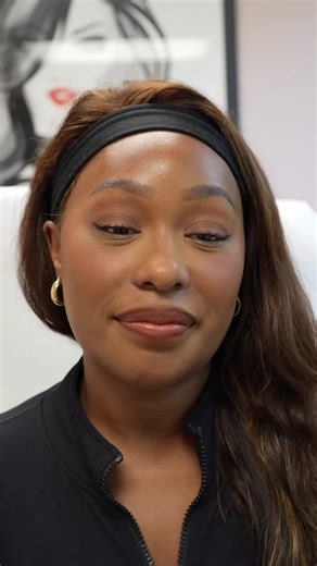 One of my specialties is ethnic rhinoplasty 💙 It’s not just about refining the nose - it’s about preserving unique facial features as well. It makes me so happy to hear patients loving their results 🥰 Thank you @enchanted_noir for your kind words! #nosejob #nosejobbeforeandafter #rhinoplasty #nosejobresults #alarplasty