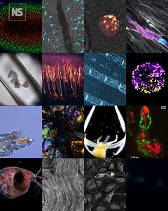 3.4K views · 118 reactions | A 48-hour time-lapse film of neurons developing in a chick embryo has won the Nikon Small World in Motion video competition. Other winning videos included the blood flow in fish, human cells infected by SARS-CoV-2, pond creatures at high magnification and a close-up of a beating zebrafish heart. | New Scientist | Facebook