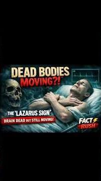 The Creepiest Thing a Dead Body Can Do… (Lazarus Sign) #LazarusSign#MedicalFacts#CreepyFacts #fact