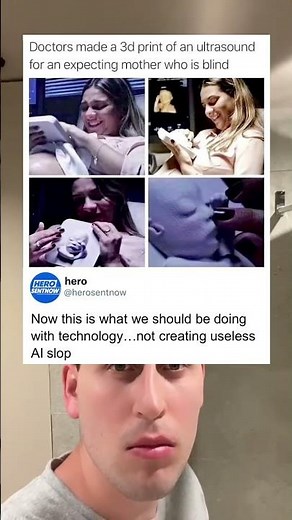 Doctors 3D print baby’s ultrasound for blind mom