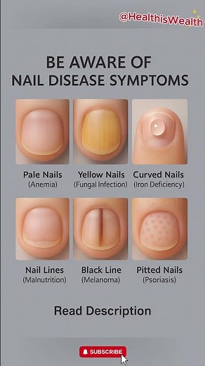 Your Nails Can Reveal Deadly Diseases Don’t Ignore These Signs #health #healthyeating
