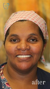 If you’re nervous about your dental implant procedure, trust our expert team! We’ll do everything we can to give you the best possible experience. Schedule your free consult today: https://bit.ly/4aKzNwE | Mile High Denture & Implant Centers - Colorado | Facebook