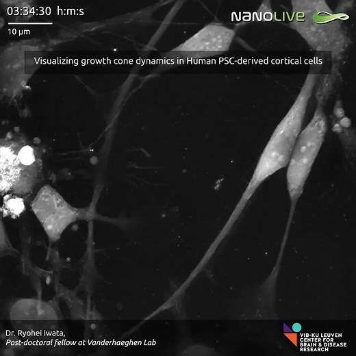 Visualizing growth cone dynamics in human PSC-derived cortical neurons