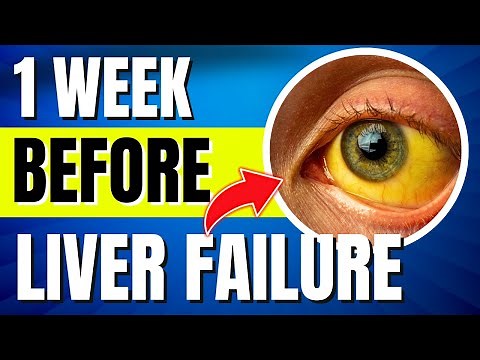 10 Liver Failure Symptoms (1 WEEK Before It's Too Late)