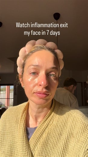 Sharee Keren | Glow & Longevity Coach on Instagram: "A taste of the SK Rituals MINI Method: First, sunlight in the early morning. When light hits your pupils, it tells your body to release cortisol in the healthy way, the awakening way… not the stress way. That same sunlight also triggers your melatonin timer so your body knows exactly when to fall asleep 16 hours later. Activate lymphatic system. Your lymph is your drainage system, but it does not move on its own. If you do not move it, nothing