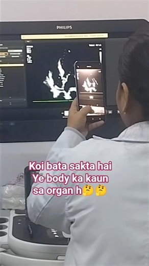 koi bataye ye kaun sa organ h?🤔🧐#organ#anatomy#shorts #ytshort #viral #explore