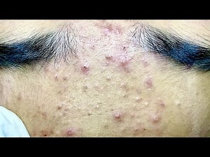 Satisfying video with Chung Vo Spa | 169