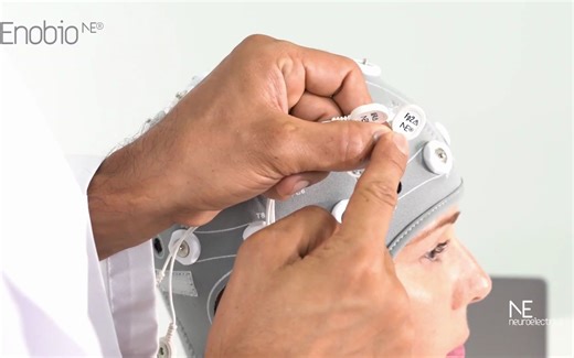 便携式脑电系统NE Enobio快速设置指南
