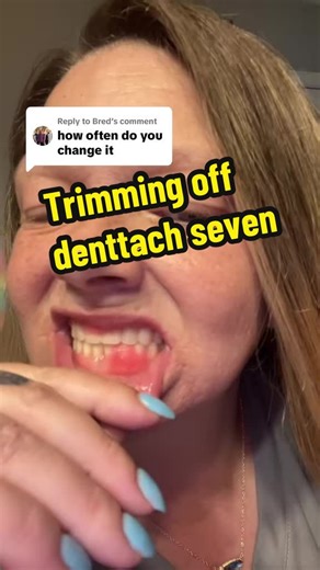 I’ll leave mine on my dentures for about two weeks. A good rule of thumb is when it starts to lift its time to change ! #dentureconfidence #denturesatayoungage #dentures #denturesandbeauty