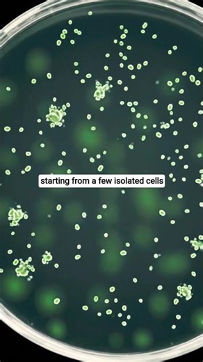 Bacteria Colonies Growing Under Microscope