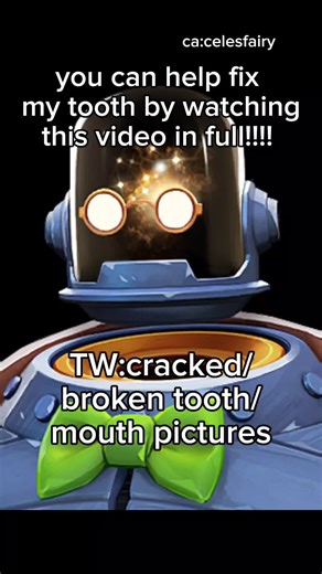 i may do a dynamo gaming live stream to sponsor fixing my tooth, if that seems like a good idea to others as well. im really scared and in pain, but trying to keep it together and be gentle in the meantime. teeth are such a privilege to have, i want so much to not suffer the same fates as my family. help my save my teeth and the big belly will keep making videos for you to giggle and smile about #deadlock #dynamo #dentalcare #teethcare #mutualaid