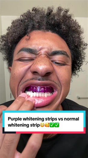 Who will be the winner!#tiktokshopjumpstartsale #newyearnewme #teeth #whiteningstrips #yellowteeth