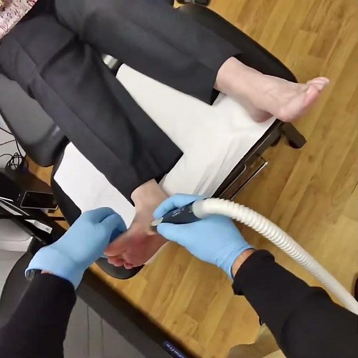 Ultimate Callus Removal Transformation Foot Care Tips #FootCare #CallusRemoval