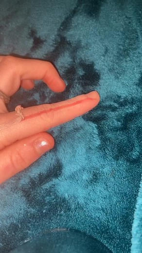 Peely Finger Skin Makeup Removal Tutorial