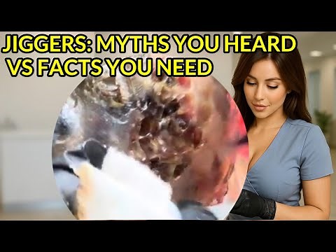 Jiggers Myths vs Facts Explained