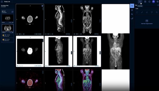 Flywheel Unveils New Viewer Updates | Flywheel