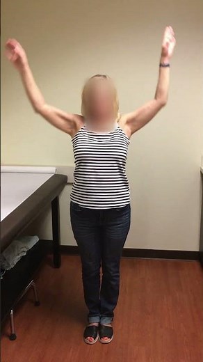 6 month PO proximal humerus fracture