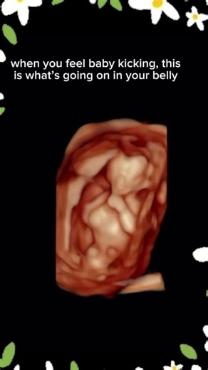 When you get that sharp rib kick — your baby is doing THIS #shorts