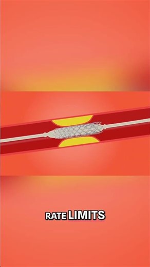 Claude Code: Amazing Features, BUT Huge Rate Limit Problems! #shorts