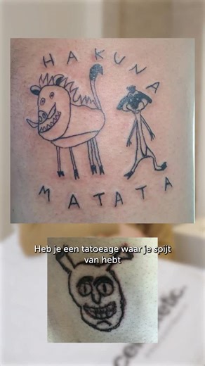 Karel Gruyaert Clinic Huidverbetering & Medische Esthetiek on Instagram: "Tatoeage beu? Met onze pico-laser verwijderen we tatoeages sneller, preciezer en met minimale huidbelasting. Veilig. Doeltreffend. Professioneel. #karelgruyaert #huidverbetering #picolaser #tattoo #tattooremovalspecialists"