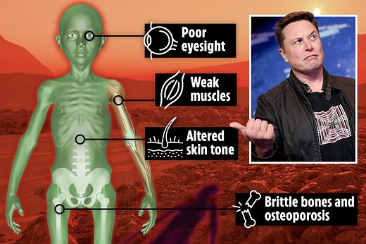 Elon Musk's 'martian' kids would have brittle bones & new skin tone