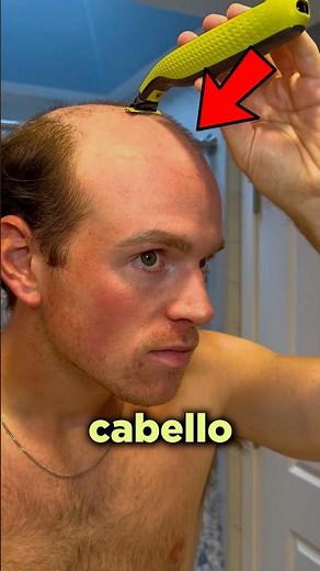 Go Bald to Have Hair for Only $30!