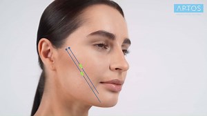 ➰ Light Lift Spring is a spirally-wrapped thread around a lancet...