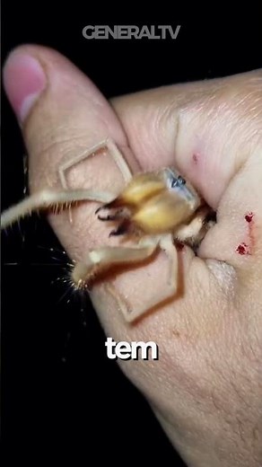 Why do camel spiders chase YOU? 😱