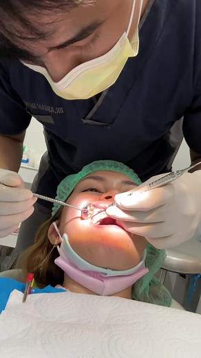 fixed bridge 🤗 #zhaliorsua