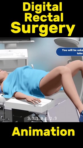 Rectal Examination (PR) Digital Rectal Surgery This video is for education purpose only #rectal #pr #digitalrectal #rectal #surgery Animation#pph#procedure#stapled#hemorrhoid#surgery #peyroniesdisease #privatepart #genderchange #Igbt #genderchange #genderchangechallenge #genderchanger #genderafiringsurgeryNIM ATION #genderchangesurgery #genderaffirming #genderaffirmation #genderaffirmationsurgery #genderaffirmationg #maletofemale #femaletomale #transgender #peyronie