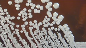 Vomiting bug spreading in US as CDC warns cases could be from FOOD or skincare