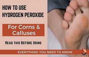 Hydrogen Peroxide for Corns & Calluses: How to Safely Use - Sasily Skin