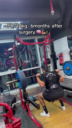 Meniscus Surgery Recovery and Fitness Motivation
