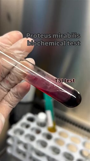Microbiogram on Instagram: "The key biochemical characteristics of Proteus mirabilis are demonstrated: 🔬 TSI Agar • Alkaline slant / Acid butt (K/A) • Glucose fermentation without gas or H₂S production 🧪 Urease Test • Strong urease activity • Rapid color change indicating urea hydrolysis 🧫 Indole Test • Indole negative reaction These biochemical reactions are essential for the laboratory identification and differentiation of Proteus mirabilis from other Enterobacterales. #microbiology #microb