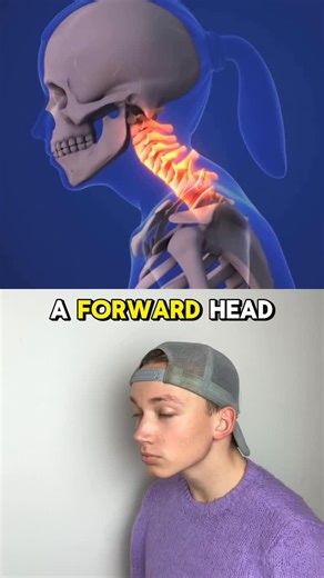 @fitmaccc on Instagram: "Most people with forward head posture are told to stretch or strengthen their neck. And while that helps… it often doesn’t fix the problem. Here’s why. Forward head posture is rarely just a neck issue. In many cases, it’s a breathing issue. When your diaphragm—the primary muscle responsible for breathing—isn’t doing its job, your body compensates by using accessory muscles like your neck and upper traps to breathe. Over time, these muscles stay overactive, tight, and lit