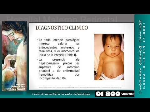 ICTERICIA NEONATAL