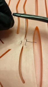 Horizontal mattress suture #dentistry #learningtips #BitesnBraces #medical #tooth #dentista #dentist #dental | Bites & Braces Dental