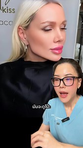 5K views · 34 reactions | เป๊ะแบบ มุมกรามคมกริบ‼️‍♀️ #NevaClinic #NevaClinicใส่ใจทุกรายละเอียด #NevaClinicdrnew #Nevaclinicbydoctornewkb #NevaClinicdrprim #filler #ฟิลเลอร์ #ฟิลเลอร์กราม #ฟิลเลอร์ปรับรูปหน้า | NEVA Clinic By Doctor New | Facebook