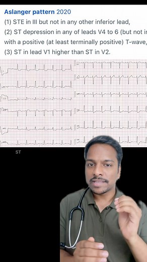 NSTEMI which is actually not a NSTEMI #stemi #mi #medicine #ecg # #mbbs #neetpg #aslangerpattern #ekg #mredical | DrVishal Gabale