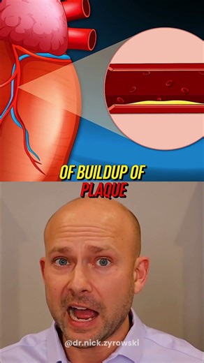 Boost Your Heart Health With NAC ( N-Acetyl Cysteine)