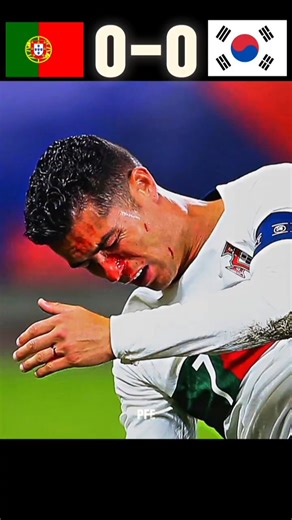 Cristiano Ronaldo Goes Down Injured… Then Shocks South Korea! 🇵🇹🔥